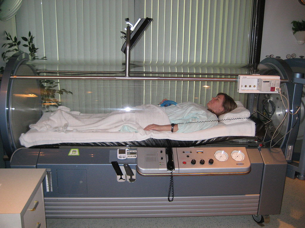 Commercial diver receives hyperbaric treatment after a diving accident
