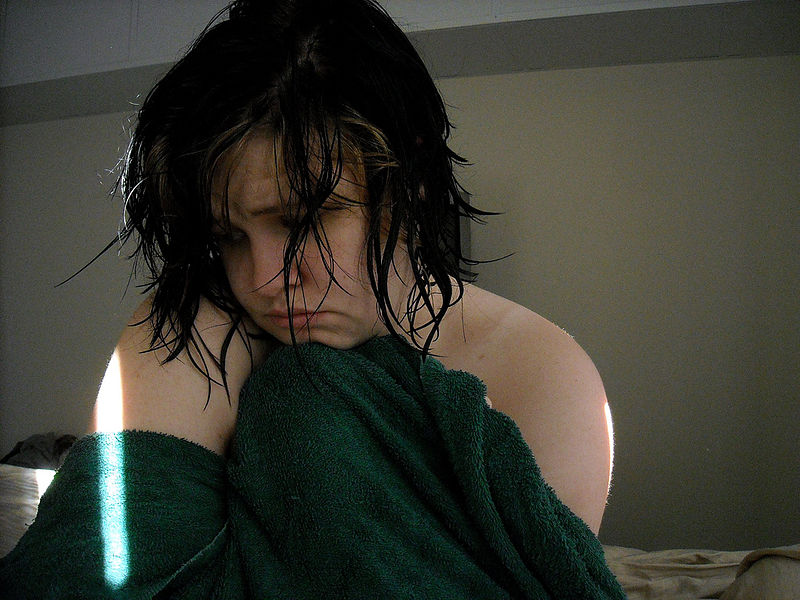 An untreated depressed adolescent who loves diving sits on the edge of a bed with a sad expression before visiting with her doctor