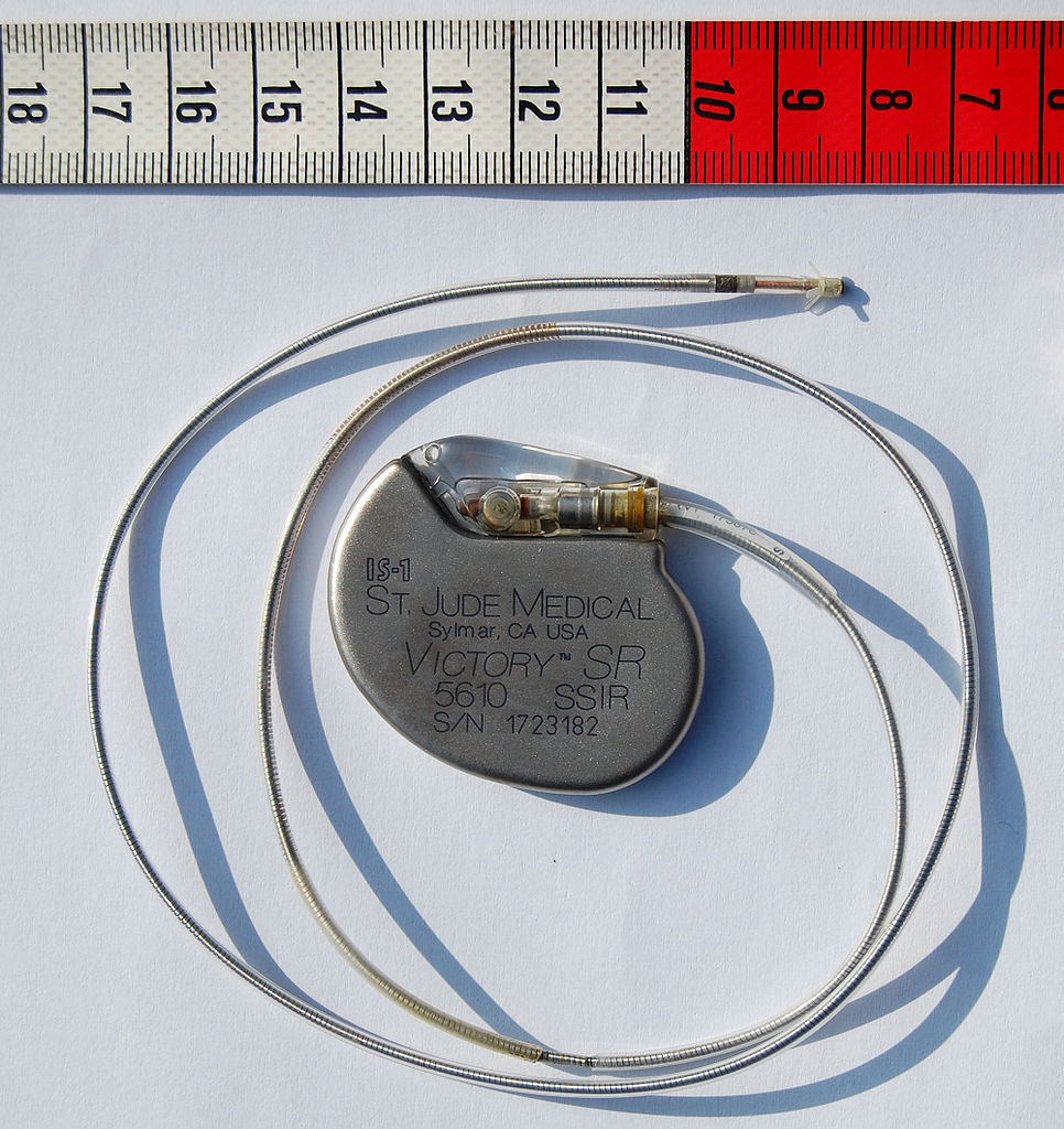 Artificial cardiac pacemaker manufactured by St. Jude